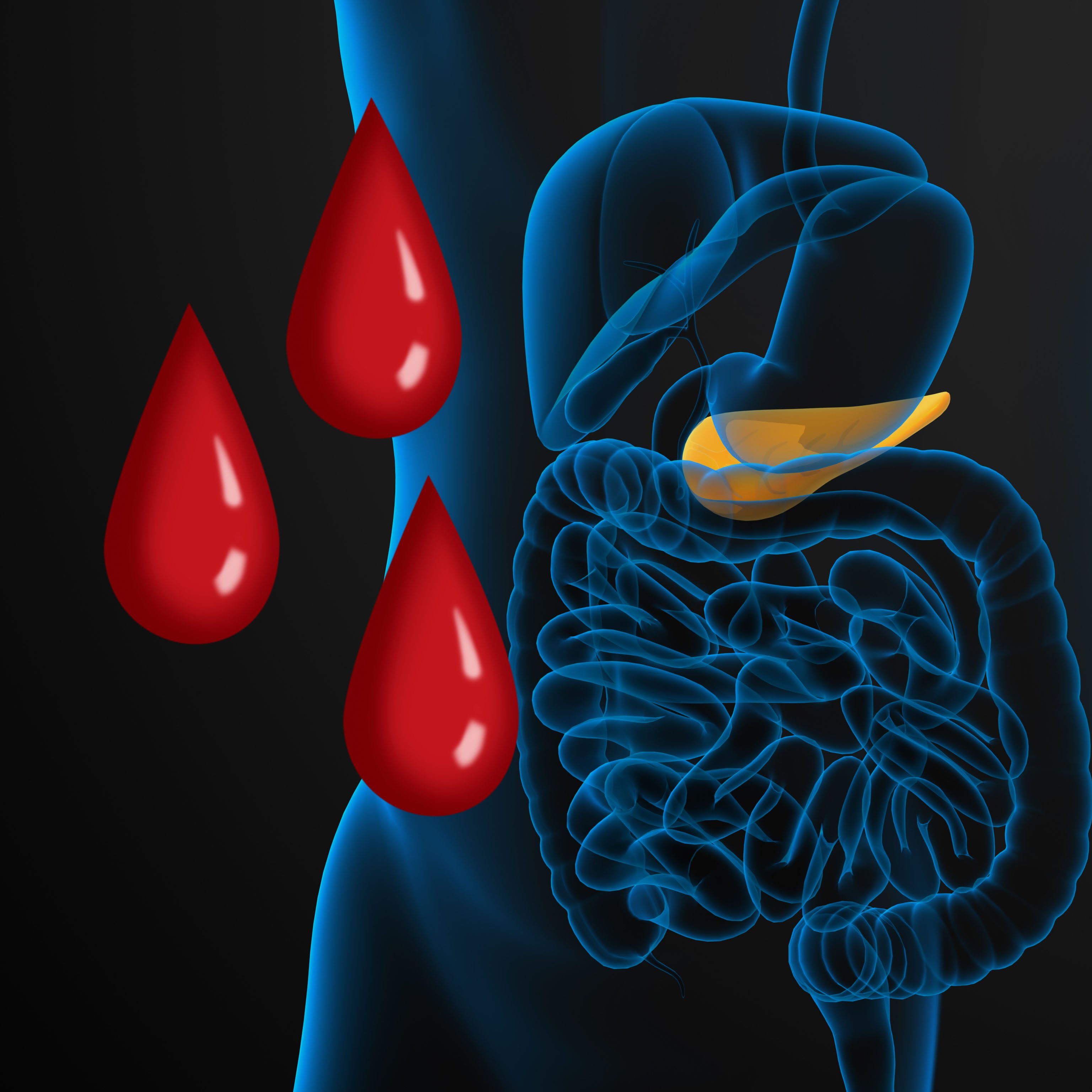 pancreatic cancer biomarkers