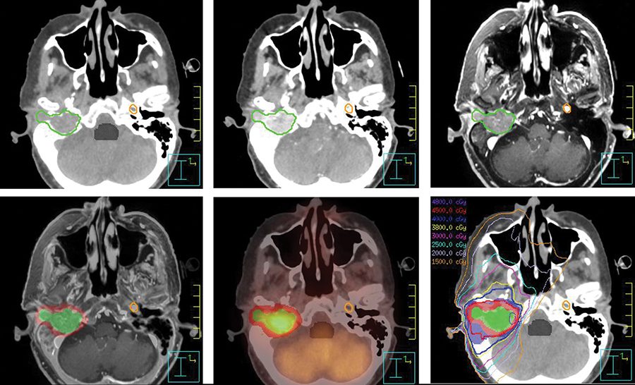 CT，MRI，PET-CT扫描